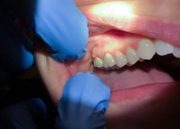 Best Emergency TMJ Treatment in Ocean Grove, NJ